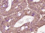 Phospho-IRAK1 (Thr209) Antibody in Immunohistochemistry (Paraffin) (IHC (P))