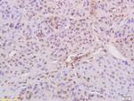 Phospho-IRS1 (Ser636, Ser639) Antibody in Immunohistochemistry (Paraffin) (IHC (P))