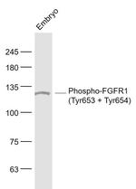 Phospho-FGFR1 (Tyr653, Tyr654) Antibody in Western Blot (WB)