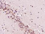 Phospho-HER3 (Tyr1197) Antibody in Immunohistochemistry (Paraffin) (IHC (P))