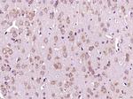 Phospho-HER3 (Tyr1197) Antibody in Immunohistochemistry (Paraffin) (IHC (P))