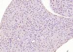 Phospho-HER4 (Tyr1284) Antibody in Immunohistochemistry (Paraffin) (IHC (P))