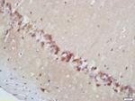 Phospho-MAPKAPK2 (Thr222) Antibody in Immunohistochemistry (Paraffin) (IHC (P))