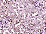 Phospho-MAPKAPK2 (Thr222) Antibody in Immunohistochemistry (Paraffin) (IHC (P))