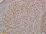 Phospho-MEF2A (Thr312) Antibody in Immunohistochemistry (Paraffin) (IHC (P))