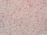 Phospho-MEF2A (Thr312) Antibody in Immunohistochemistry (Paraffin) (IHC (P))