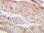 Phospho-MEF2A (Thr312) Antibody in Immunohistochemistry (Paraffin) (IHC (P))