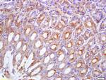 Phospho-c-Met (Tyr1234, Tyr1235) Antibody in Immunohistochemistry (Paraffin) (IHC (P))