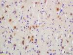 Phospho-MKK3 (Ser218, Ser207) Antibody in Immunohistochemistry (Paraffin) (IHC (P))