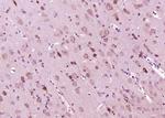 Phospho-MEK6 (Ser207) Antibody in Immunohistochemistry (Paraffin) (IHC (P))