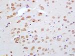 Phospho-Merlin (Ser518) Antibody in Immunohistochemistry (Paraffin) (IHC (P))