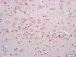 Phospho-NMDAR1 (Ser890) Antibody in Immunohistochemistry (Paraffin) (IHC (P))