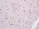 Phospho-PKR (Thr446) Antibody in Immunohistochemistry (Paraffin) (IHC (P))