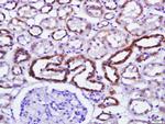 Phospho-PKR (Thr446, Thr451) Antibody in Immunohistochemistry (Paraffin) (IHC (P))