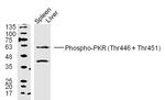 Phospho-PKR (Thr446, Thr451) Antibody in Western Blot (WB)