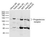 Phospho-Progesterone Receptor (Ser190) Antibody in Western Blot (WB)
