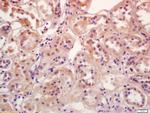 Phospho-SGK1 (Ser78) Antibody in Immunohistochemistry (Paraffin) (IHC (P))