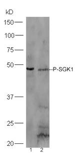 Phospho-SGK1 (Ser78) Antibody in Western Blot (WB)