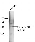 Phospho-SGK1 (Ser78) Antibody in Western Blot (WB)