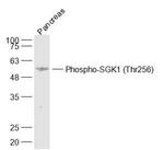 Phospho-SGK1 (Thr256) Antibody in Western Blot (WB)
