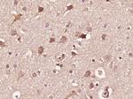 Phospho-INPPL1 (Tyr1135) Antibody in Immunohistochemistry (Paraffin) (IHC (P))