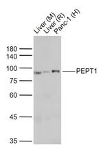 PEPT1 Antibody in Western Blot (WB)