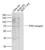 FSH receptor Antibody in Western Blot (WB)