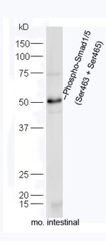 Phospho-Smad1/5 (Ser463, Ser465) Antibody in Western Blot (WB)