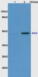 Phospho-Smad3 (Ser423, Ser425) Antibody in Western Blot (WB)