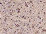 Phospho-Tyk2 (Tyr1054, Tyr1055) Antibody in Immunohistochemistry (Paraffin) (IHC (P))