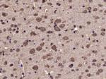 Phospho-Tyk2 (Tyr1054, Tyr1055) Antibody in Immunohistochemistry (Paraffin) (IHC (P))