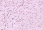 Phospho-Tau protein (Ser396) Antibody in Immunohistochemistry (Paraffin) (IHC (P))