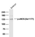 Phospho-eNOS (Ser1177) Antibody in Western Blot (WB)