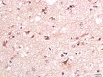 Phospho-Torc1 (Ser151) Antibody in Immunohistochemistry (Paraffin) (IHC (P))