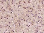 Phospho-HER3 (Tyr1289) Antibody in Immunohistochemistry (Paraffin) (IHC (P))