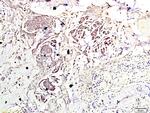 Phospho-mTOR (Ser2448) Antibody in Immunohistochemistry (Paraffin) (IHC (P))