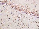 Phospho-mTOR (Ser2448) Antibody in Immunohistochemistry (Paraffin) (IHC (P))