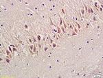 Synapsin 1 Antibody in Immunohistochemistry (Paraffin) (IHC (P))