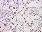 MST1 Antibody in Immunohistochemistry (Paraffin) (IHC (P))