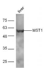 MST1 Antibody in Western Blot (WB)