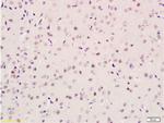 ID2 Antibody in Immunohistochemistry (Paraffin) (IHC (P))