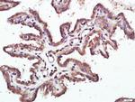 Raptor Antibody in Immunohistochemistry (Paraffin) (IHC (P))