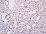 StAR Antibody in Immunohistochemistry (Paraffin) (IHC (P))