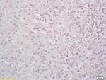 StAR Antibody in Immunohistochemistry (Paraffin) (IHC (P))