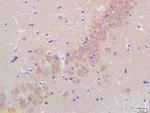 ADAMTS5 Antibody in Immunohistochemistry (Paraffin) (IHC (P))