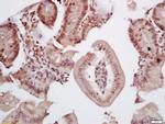 TIF1 gamma Antibody in Immunohistochemistry (Paraffin) (IHC (P))