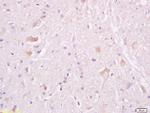 Tuberin Antibody in Immunohistochemistry (Paraffin) (IHC (P))