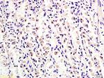 Tuberin Antibody in Immunohistochemistry (Paraffin) (IHC (P))