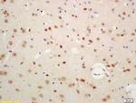 SIAH1 Antibody in Immunohistochemistry (Paraffin) (IHC (P))