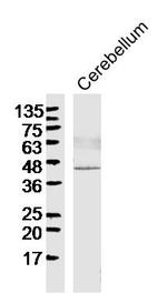 SIAH1 Antibody in Western Blot (WB)